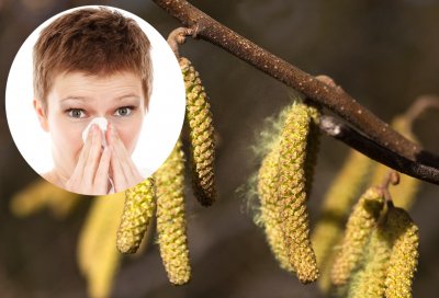 VEĆ JE POČELO Neuobičajeno toplo vrijeme uzrokovalo raniji početak sezone alergija