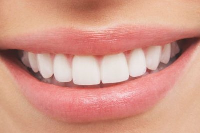 Otišla kod stomatologa na ugradnju implatanta, vratila se s oštećenjem zubiju i zubnog mesa