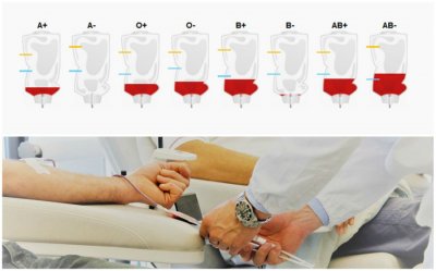HITAN APEL Nestašica svih krvnih grupa u varaždinskoj bolnici, donirajte krv!