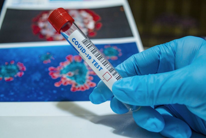 U Varaždinskoj županiji dva nova slučaja zaraze koronavirusom, radi se o mlađim osobama