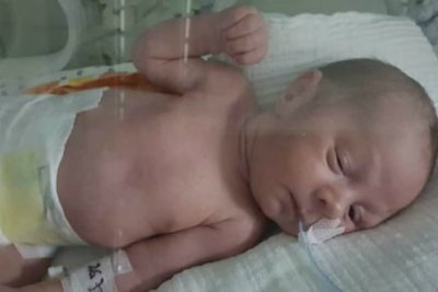 Karlu treba pomoć: Novorođenčetu oštećen mozak, spas se traži u klinici u Istanbulu