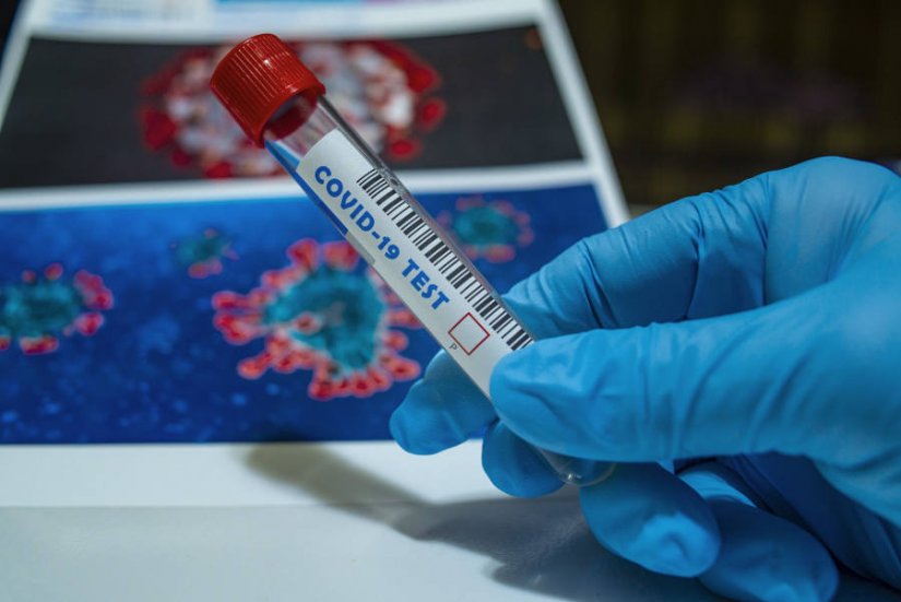 U Međimurju evidentirano 213 novih slučajeva zaraze koronavirusom