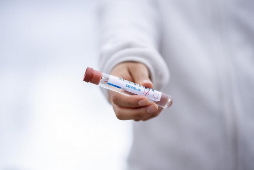 Od 7.499 testiranih, u Hrvatskoj 962 nova slučaja zaraze koronavirusom