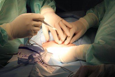 Kirurgu stroža kazna zbog nepodobnog liječenja pacijenta koji je umro
