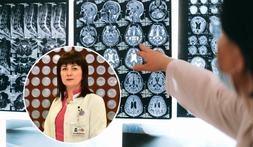 Vježbanje može usporiti progresiju simptoma Parkinsonove bolesti